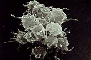 Image: Scanning electron micrograph of a clump of activated platelets (Photo courtesy of Brown University).