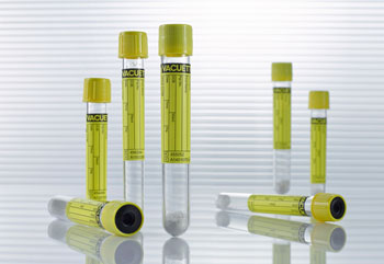 Caption: The new VACUETTE Urine CCM tube contains a highly soluble powder that quickly impedes bacterial growth upon simple mixing with urine sample via a few inversion of the tube. This enables an accurate determination of bacteria count at the time of urine sampling for up to 48 hours at room temperature (Photo courtesy of Greiner Bio-One).