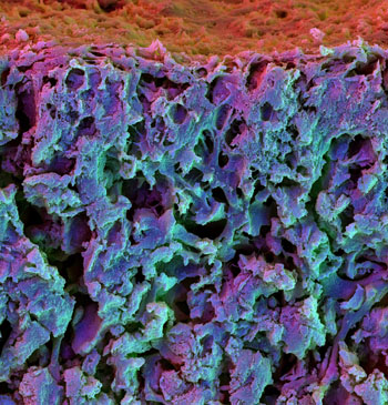 Image: Scanning electron microscope image of the cross section of a fast relaxing hydrogel containing mesenchymal stem cells. The cells differentiated into osteoblasts and integrated in the matrix (Photo courtesy of Harvard University).