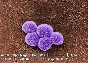 Image: Colorized scanning electron micrograph (SEM) shows a grouping of methicillin resistant Staphylococcus aureus (MRSA) bacteria magnified 20,000 times (Photo courtesy of the CDC – US Centers for Disease Control and Prevention).