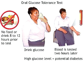 Image: Steps in the oral glucose tolerance test; if the blood sugar level is 140 to 199 mg/dL, the person has prediabetes or impaired glucose tolerance (IGT) (Photo courtesy of Penn Medicine).