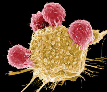 Цветной снимок, полученный с помощью сканирующего электронного микроскопа, демонстрирующий T-лимфоциты (розовые), которые распознают антигены на опухолевой клетке (желтая) посредством T-клеточных рецепторов (фото любезно предоставлено Стивом Гшмейсснером (Steve Gschmeissner)).
