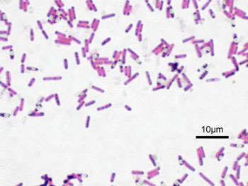 Image: Gram-stained Bacillus subtilis bacteria (Photo courtesy of Wikimedia Commons).