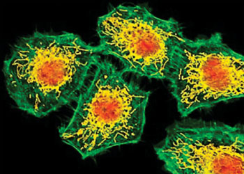 Image: Confocal micrograph of immunohistochemically stained human glioblastoma (hGBM) cells (Photo courtesy of Olympus).
