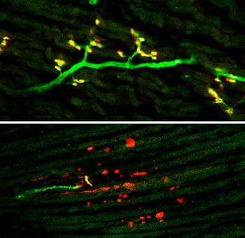 Image: The micrographs show the synapses between motor neurons and muscle that are normal in control mice (top). In mice lacking the microRNA molecule miRNA-218, neuromuscular junctions are severely defective and motor neurons undergo neurodegeneration (bottom). Pre-synaptic motor axons are in green, and post-synaptic acetylcholine receptors expressed by muscle are in red. Areas of overlap in yellow identify correctly formed neuromuscular junctions (Photo courtesy of the Salk Institute for Biological Sciences).