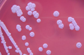 Image: Burkholderia pseudomallei colonies of on Ashdown\'s agar after four days\' incubation showing the characteristic cornflower head morphology (magnified 5x) (Photo courtesy of Wikimedia Commons).