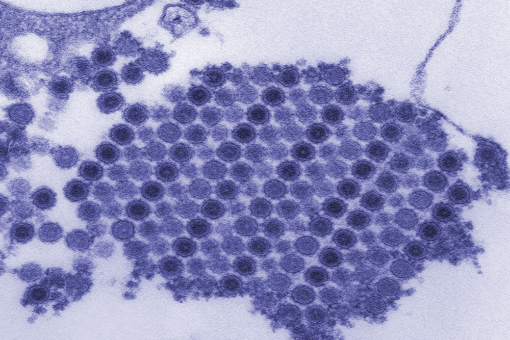 Снимок, полученный с помощью трансмиссионного электронного микроскопа, показывающий многочисленные частицы вируса чикунгунья, которые состоят из расположенного в центре плотного ядра, окруженного оболочкой вируса (фото любезно предоставлено Синтией Голдсмит (Cynthia Goldsmith)).