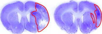Image: Brain damage is outlined in red for rats that were treated to block one type of RNA (right), compared to controls (left) (Photo courtesy of Raghu Vemuganti, Suresh Mehta and TaeHee Kim, University of Wisconsin-Madison).
