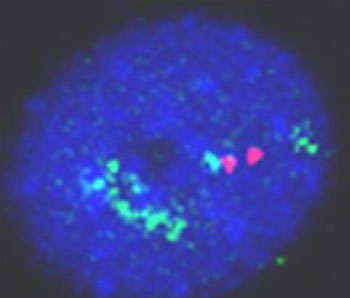 Image: The micrograph shows a lung cancer cell in which extra copies of the ADAR1 gene are shown in green. Two normal copies of a control gene are shown in red (Photo courtesy of Bellvitge Biomedical Research Institute).
