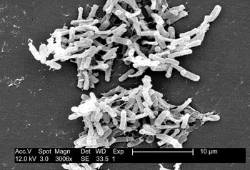 Image: Scanning electron micrograph of Clostridium difficile bacteria from a stool sample (Photo courtesy of the CDC - [US] Centers for Disease Control and Prevention).