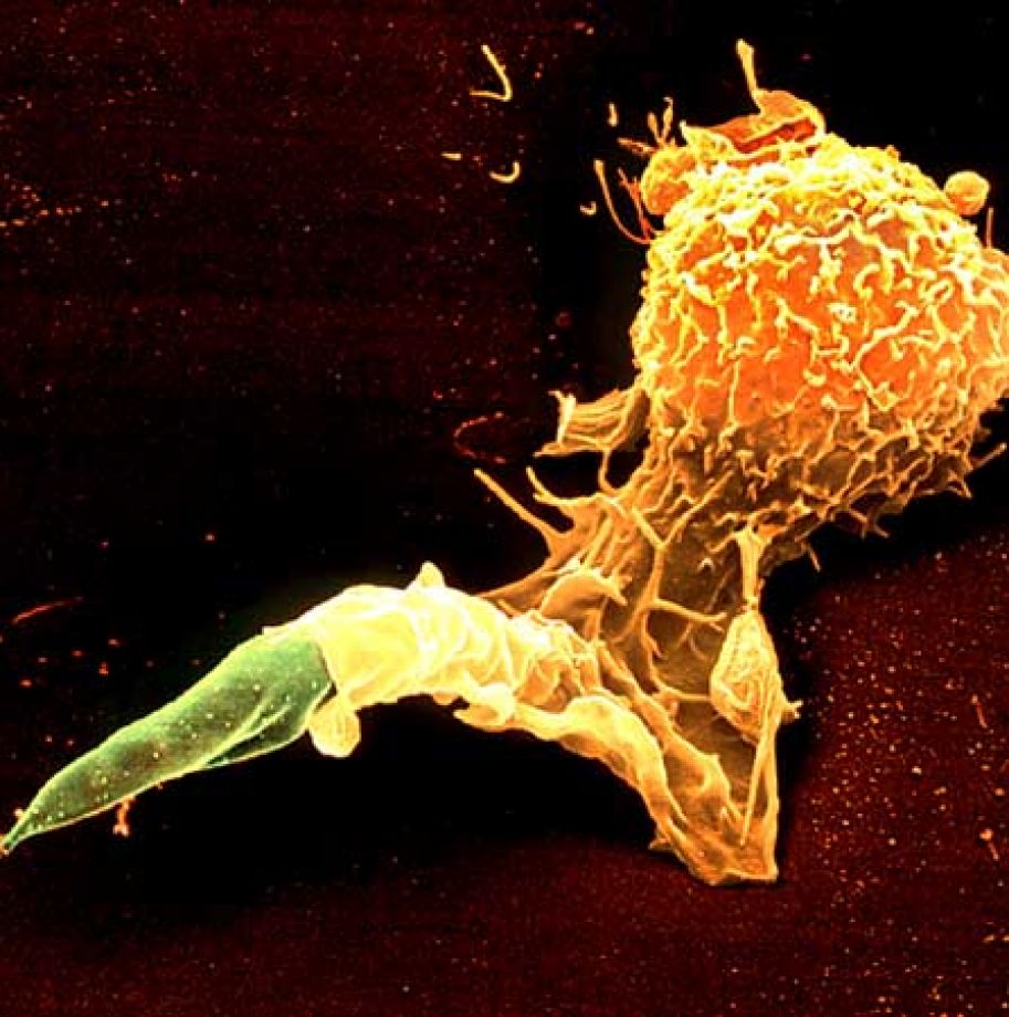 Цветной снимок, полученный с помощью сканирующего электронного микроскопа, на котором видно, как лейкоцит-макрофаг поглощает промастиготу лейшмании (фото любезно предоставлено Юргеном Бергером (Juergen Berger)).