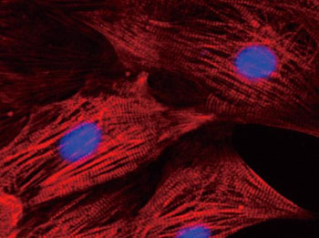 Image: Micrograph of normal heart cells (cardiomyocytes). Nuclei are shown in blue (Photo courtesy of Yoshida Laboratory, Kyoto University).
