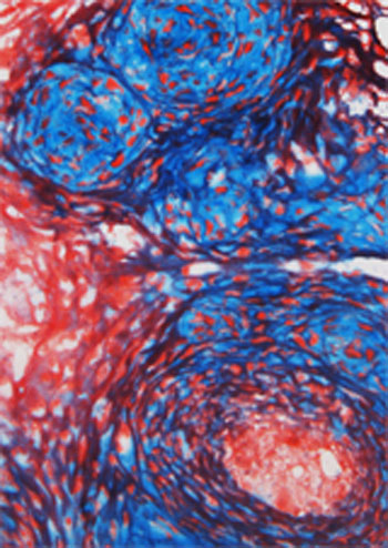 Image: Heterogeneous tissue engineered constructs reproduce the microstructural, micromechanical, and mechanobiological features of the fibrous and proteoglycan-rich microdomains in native fibrocartilage. Image shows interactions between fibrous (red) and proteoglycan–rich (blue) microdomains after one week of culture (Photo courtesy of Drs. Su Chin Heo and Woojin Han, University of Pennsylvania).
