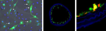 Image: On the left are fluorescence-labeled cells with nanoparticles: The cellular nuclei are shown in blue, the fluorescence labeling is shown in green, and the nanoparticles in the cells are identified by arrows. The middle photo shows a blood vessel populated with these cells (green). On the right is a detailed image of a vascular wall with the eNOS protein identified (red) (Photo courtesy of Dr. Sarah Rieck/Dr. Sarah Vosen, University of Bonn).