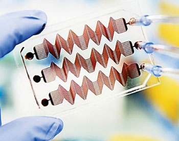 Image: Novel hemostasis monitoring microdevice comprises a microfluidic mechanism with hollow channels through which blood is flowed and a proprietary algorithm for analyzing patient-specific data to predict when blood clots will form (Photo courtesy of Wyss Institute).