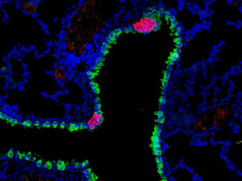 Image: Pulmonary neuroendocrine cells (red) are rare cells found in clusters along the mammalian airway, where they act as sensors, sending information to the central nervous system. These clusters are found interspersed among other airway epithelial cells (green) (Photo courtesy of Dr. Leah Nantie, University of Wisconsin).