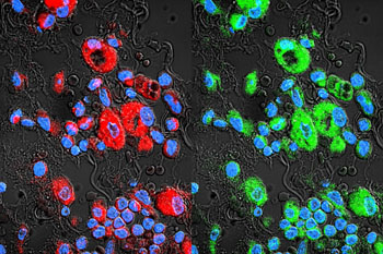 Image: Drug-resistant lung cancer cells are in red. Paclitaxel-loaded exosomes (green) swarm the cancer cells and bypass their drug resistance (Photo courtesy of the University of North Carolina).