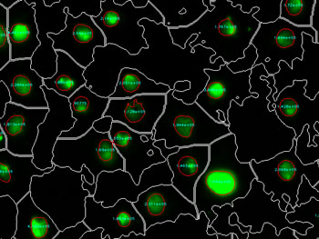 Image: The “cellXpress” automated imaging analysis software enables to efficiently and accurately detect cellular responses (reflected in green) to nephrotoxic compounds (Photo courtesy of Agency for Science, Technology and Research (Singapore)).