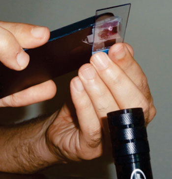 Image: Phone microscopy slide reading: the technique for reading a slide using the ball-lens phone microscope with a single light-emitting diode (LED) flashlight providing illumination (Photo courtesy of University of Texas Houston Health Science).
