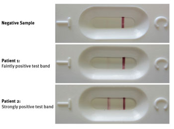 Image: The circulating cathodic antigen immunochromatographic test of two patient’s urine for Schistosoma mansoni (Photo courtesy of Saarland University).