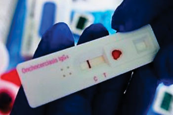 Image: The SD BIOLINE Onchocerciasis IgG4 rapid test preproduction prototype (Photo courtesy of  PATH/Dunia Faulx).