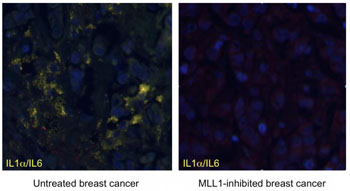 Image: Human breast cancers (blue) grown on mice show marked reductions in inflammatory cytokines such as IL1a and IL6 (yellow) when MLL1 is inhibited (Photo courtesy of Dr. Brain Capell, University of Pennsylvania).