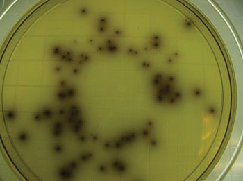 Image: Colonies of typical Listeria monocytogenes as they appear when grown on Listeria-selective agar (Photo courtesy of Dr. James Folsom).