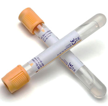 Image: BD serum-separating advance vacutainer tubes (SST II) (Photo courtesy of Becton Dickinson).