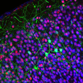 Image: Callosal projection neurons (green) are shown in the cerebral cortex (Photo courtesy of Dr. Jessica MacDonald and Dr. Jeffrey Macklis, Harvard University).