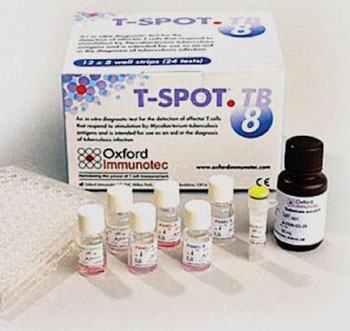 Image: The T-SPOT.TB enzyme-linked immunospot test kit for tuberculosis (Photo courtesy of Oxford Immunotec International).