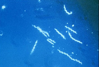 Image: Lyme disease is caused by the spirochete bacterium Borrelia burgdorferi. The photomicrograph shows the typical corkscrew appearance of the spirochete (Photo courtesy of the CDC - US Centers for Disease Control and Prevention).