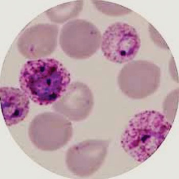 Image: Photomicrograph of Plasmodium vivax malaria parasites in a thin blood smear (Photo courtesy of the Pasteur Institute Cambodia).