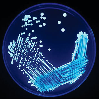 Image: Legionella sp. colonies growing on an agar plate and illuminated using ultraviolet light to increase contrast (Photo courtesy of CDC/James Gathany).