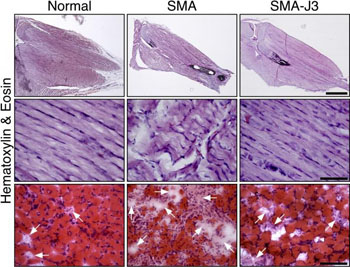 Image: From left to right: Microscopic images comparing the hind leg muscles of normal mice, mice with spinal muscular atrophy, and mice with spinal muscular atrophy that have had the enzyme Jnk3 inhibited. Jnk3 deficiency appears to reduce muscle degeneration (muscle-wasting) and increase muscle growth in mice with the disease (Photo courtesy of the journal Human Molecular Genetics).