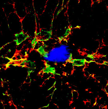 Image: Microglia (green) surround an amyloid plaque (blue) in the brain of an Alzheimer\'s disease mouse model. Endogenous mouse antibodies (red) associate with microglia in the brains of such mice and boost the microglia\'s ability to degrade plaques (Photo courtesy of Dr. Samuel Marsh, University of California, Irvine).