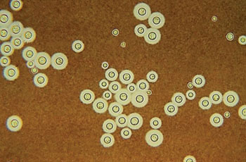 Image: Photomicrograph of Cryptococcus neoformans using a light India ink staining preparation. Life-threatening infections caused by the encapsulated fungal pathogen Cryptococcus neoformans have been increasing steadily over the past 10 years because of the onset of AIDS, and the expanded use of immunosuppressive drugs (Photo courtesy of CDC/Dr. Leanor Haley).