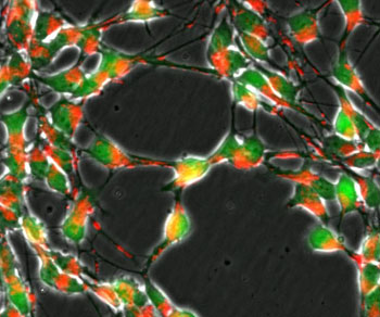 Image: Loss of the DJ-1 gene in nerve cells (green) impairs the transport of mitochondria (red) and important metabolic pathways of the cellular respiration (Photo courtesy of the University of Luxembourg).
