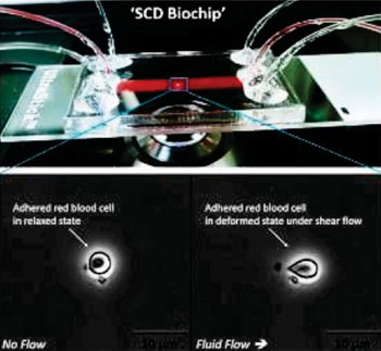 Image: The “SCD biochip” microfluidic system for probing red blood cell (RBC) dynamic deformability and adhesion from whole sickle cell disease (SCD) patient blood samples (Photo courtesy of Case Western Reserve University).