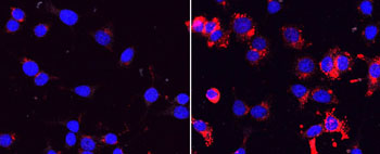 Image: Human beta cells grown in culture (blue). Cells on right were induced to undergo senescence, causing them to secrete more insulin, stained in red (Photo courtesy of Dr. Ronny Helman, the Hebrew University of Jerusalem).