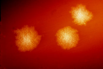 Image:  Clostridium difficile colonies after 48 hours’ growth on blood agar plate. By competitive exclusion, healthy gut flora help limit growth of pathogenic yeasts and bacteria. Overgrowth of C. difficile in the gut can cause pseudomembranous colitis, and is the most frequently identified cause of antibiotic-associated diarrhea. (Image courtesy of Dr. Holdeman, Centers for Disease Control & Prevention (CDC; image ID #3647), and Wikimedia.)
