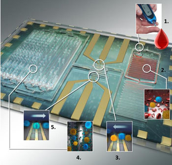 Image: Close-up of the differential immuno-capture biochip (Photo courtesy of Dr. Umer Hassan, University of Illinois).