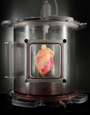 Image: A partially recellularized human whole-heart cardiac scaffold, reseeded with human cardiomyocytes derived from induced pluripotent stem cells, being cultured in a bioreactor that delivers a nutrient solution and replicates some of the environmental conditions around a living heart (Photo courtesy of Dr. Bernhard Jank, Ott Laboratory, Massachusetts General Hospital).