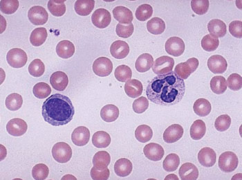 Image: Blood smear showing a segmented neutrophil and a mature lymphocyte with a single large nucleus (Photo courtesy of the University of Utah Medical School).