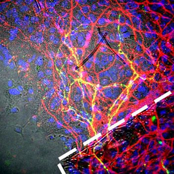 Image: Reprogrammed human neurons grown on 3D scaffolds (within the white dash line) and transplanted onto brain tissue (red) extended out (yellow lines) and integrated (Photo courtesy of Neal K. Bennett, Moghe Laboratory, Rutgers University).