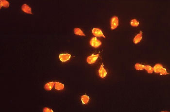 Image: Photomicrograph of a positive indirect fluorescent antibody (IFA) test for Giardia lamblia parasites (Photo courtesy of Dr. Govinda S. Visvesvara).