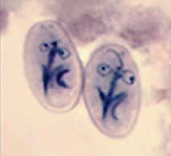 Image: Photomicrograph of stained Giardia lamblia cysts from a fecal specimen (Photo courtesy of Lynne S. Garcia, MS).