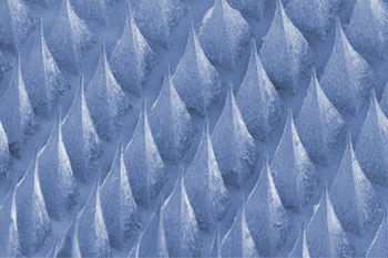 Image: A scanning electron microscopic (SEM) image of the microneedle-array beta-cell patch (Photo courtesy of Dr. Zhen Gu, University of North Carolina).