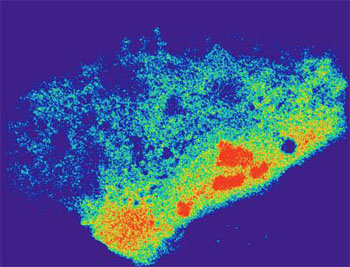 Image: Micrograph of a cell carrying an RNA-targeted Cas9 system that reveals beta-actin mRNA distribution in the cytoplasm (Photo courtesy of the University of California, San Diego).