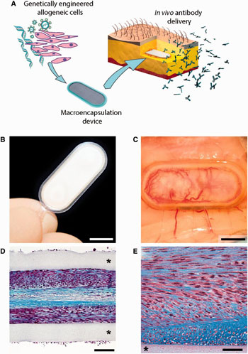 Image: Schematic representation of implant for passive immunization by long-term therapeutic antibody delivery. Cells genetically engineered to produce a therapeutic antibody are confined in a macroencapsulation “flat sheet” device and implanted in the subcutaneous tissue for in vivo antibody secretion into the bloodstream. Antibodies reaching the brain target, clear, and prevent the harmful amyloid-beta protein plaques of Alzheimer’s disease (Photo courtesy of Lathuilière A et al, 2016, and Swiss Federal Institute of Technology in Lausanne).