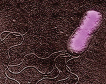 Image: Electron micrograph of Bartonella henelae, Gram-negative bacteria that causes cat scratch fever (Photo courtesy of the Prokaryotes).